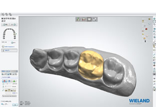CAD/CAMシステム　3shape（CAD）