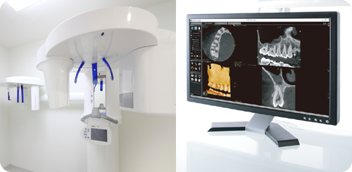 歯科用CT